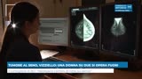 TUMORE AL SENO, VIZZIELLO: UNA DONNA SU DUE SI OPERA FUORI